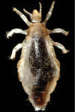 An adult female body louse