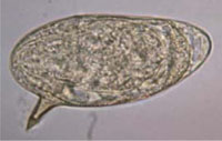 An egg from a Schistosoma parasite