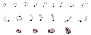Developmental stages of the malaria parasite