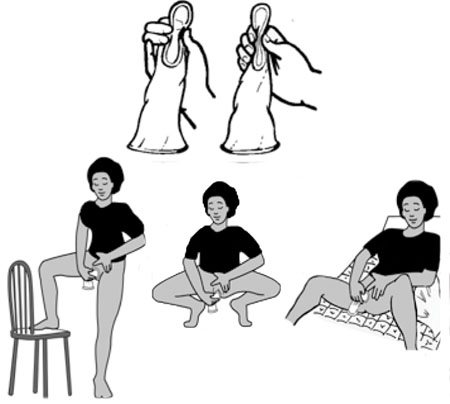 Images showing how a female condom is inserted.
