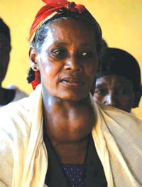 A woman displaying a symptom of goitre