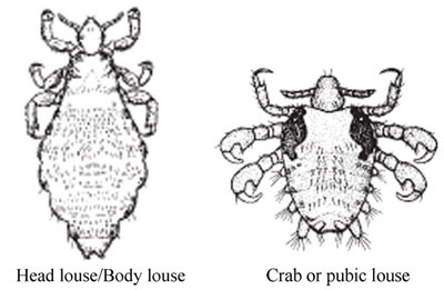 Adult lice