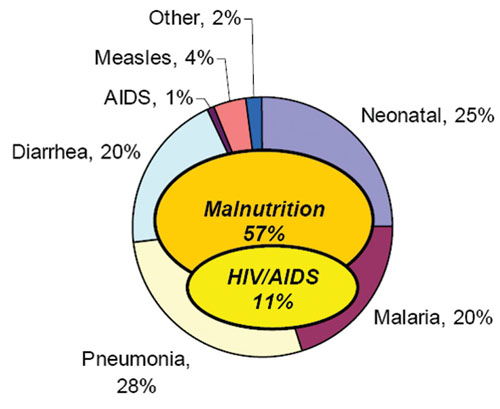 A pie chart representing the major causes of under-five mortality in Ethiopia.