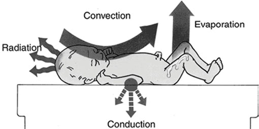A diagram of a baby and the ways in which it can lose heat from the body.