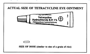Actual size of tetracycline ointment to be applied to the child’s eye.