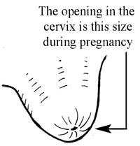 A diagram showing how small the cervix opening is during pregnancy.