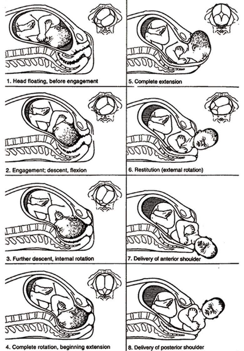 The starting position and the seven cardinal movements of the baby as it descends through the birth canal. The small pictures show the position of the baby’s head, as if you were looking up the birth canal.