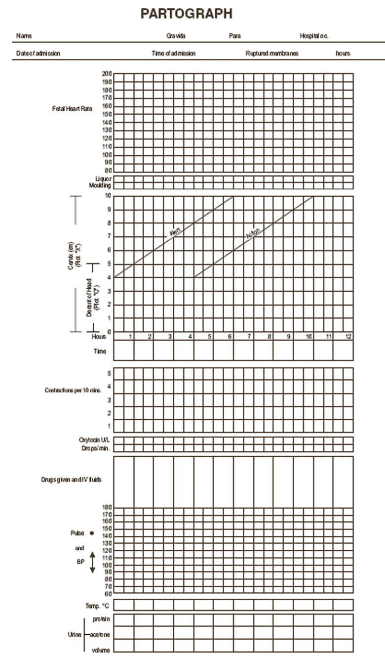 The partograph showing where to enter the patient’s identification details at the top and the graphic component below.