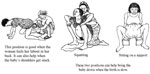 Three different positions the mother may like to be in during the second stage of labour. Position one is on all fours with face down, position 2 is squatting and position three is sitting on a support.
