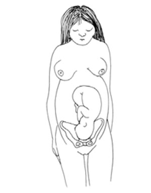 A womans pelvis is too small for her baby’s head.