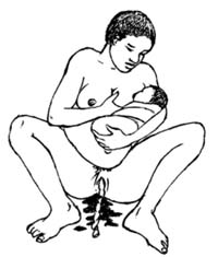 A mother is breastfeeding her newborn immediately after giving birth.
