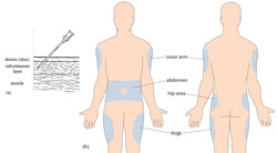 Diagram showing the penetration of a subcutaneous needle for injecting insulin. and preferable injection sites for insulin