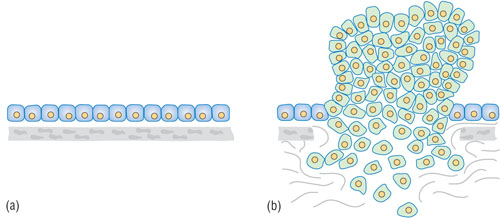 Diagram of normal and cancer cells