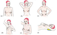 Breast self-examination