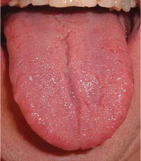 A healthy tongue