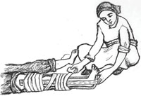 Health worker applying a split