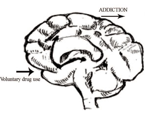 Process of development of addiction in the brain