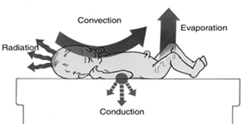 A baby lies on a platform with arrows showing the mechanisms of heat loss from a baby’s skin.