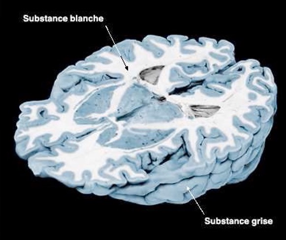 Coupe du cerveau pour voir la substance grise et la substance blanche