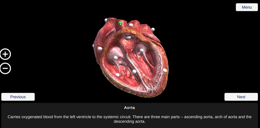 The opened heart and pins – the pin for the aorta has been selected is now green.