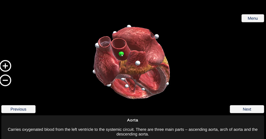 The blood vessels at the top of the heart. The aorta is indicated by the green pin.  