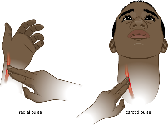 Carotid Pulse Rate