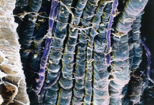 An image of the cerebral cortex viewed under the microscope.